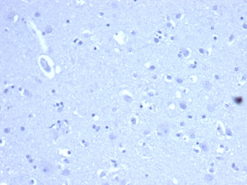 CD44 Antibody