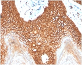 CDH1 Antibody