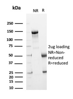 CDH1 Antibody