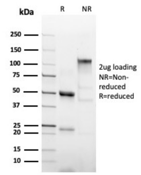 Recombinant Hexa-histidine (Epitope Tag) Antibody