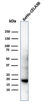 Recombinant Hexa-histidine (Epitope Tag) Antibody