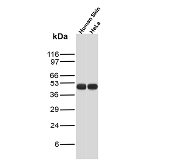 Recombinant Cytokeratin, pan (Epithelial Marker) Antibody