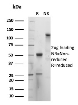 Recombinant Cytokeratin, pan (Epithelial Marker) Antibody