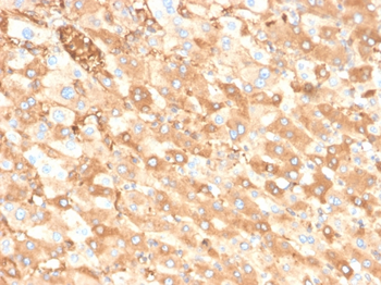 ALB Antibody