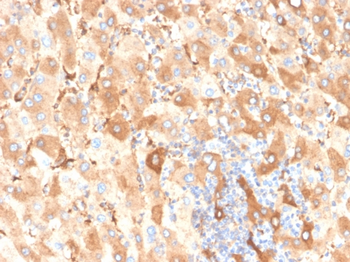 ALB Antibody