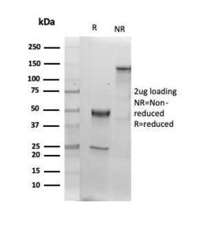 ALB Antibody