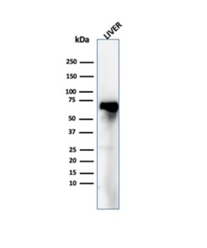ALB Antibody