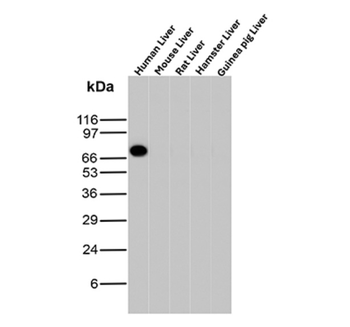 ALB Antibody