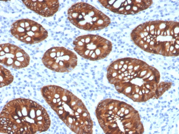 KRT8 Antibody