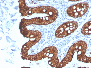 KRT8 Antibody