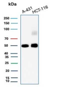 KRT8 Antibody