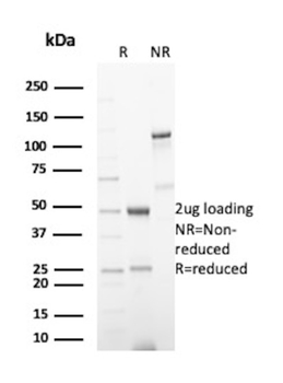 KRT8 Antibody