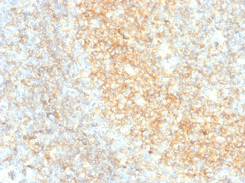 CD40 Antibody