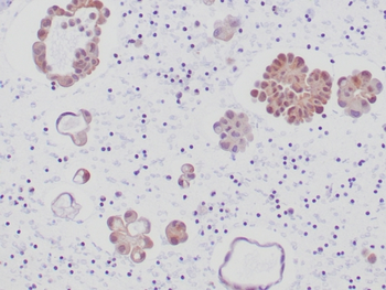ALK Antibody
