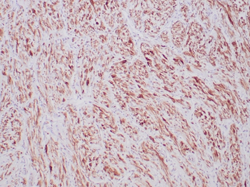 ALK Antibody