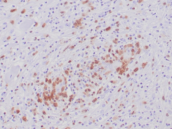 ALK Antibody