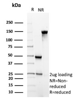ALK Antibody