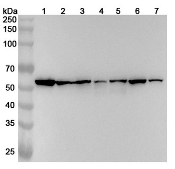 PDIA3 Rabbit Polyclonal Antibody