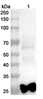 SFTSV NP/Nucleoprotein Rabbit Polyclonal Antibody