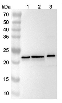RPL9P9 Rabbit Polyclonal Antibody