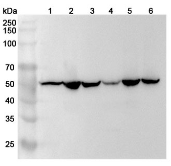 jo-1 Rabbit Polyclonal Antibody