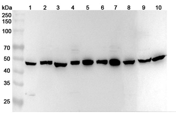 PGD Rabbit Polyclonal Antibody