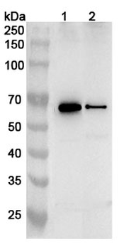 CHEK1 Rabbit Polyclonal Antibody