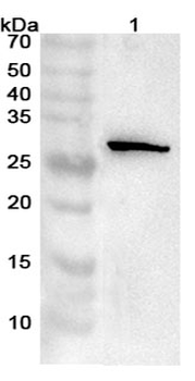 TIRAP Rabbit Polyclonal Antibody