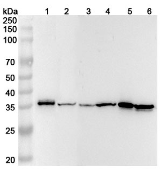 Cyclin D1 Rabbit Polyclonal Antibody