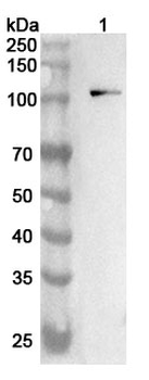 CDH3 Rabbit Polyclonal Antibody