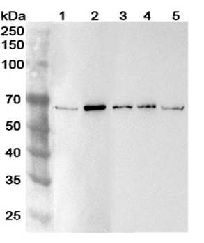 ADAM8 Rabbit Polyclonal Antibody
