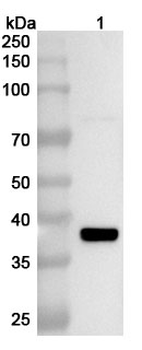 Sindbis virus(SINV) nsp2 Rabbit Polyclonal Antibody