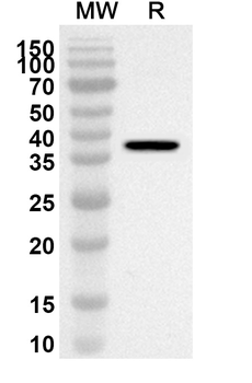 Cat Fel d 1B/CH2/Allergen FdI Rabbit Polyclonal Antibody