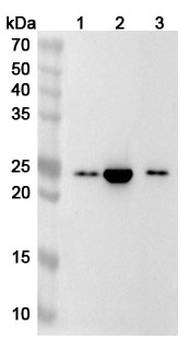 RBBP9 Rabbit Polyclonal Antibody