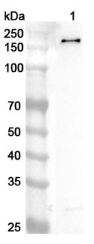 PHF14 Rabbit Polyclonal Antibody