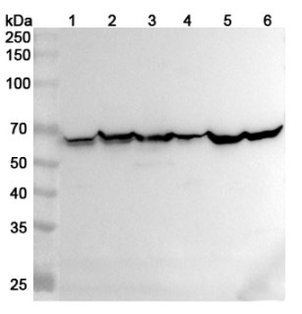 MCCC2 Rabbit Polyclonal Antibody