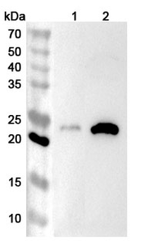 JCHAIN Rabbit Polyclonal Antibody