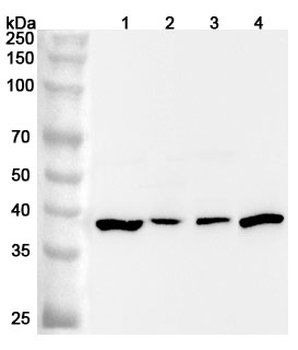 SAE1 Rabbit Polyclonal Antibody