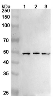 RARB Rabbit Polyclonal Antibody