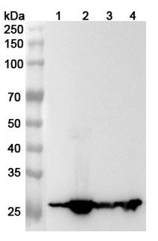 GSTM1 Rabbit Polyclonal Antibody