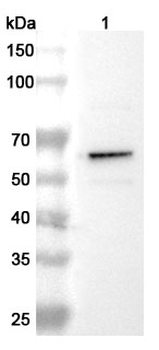 TH Rabbit Polyclonal Antibody