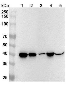 ADA/Adenosine deaminase Rabbit Polyclonal Antibody