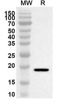 NOX1 Rabbit Polyclonal Antibody