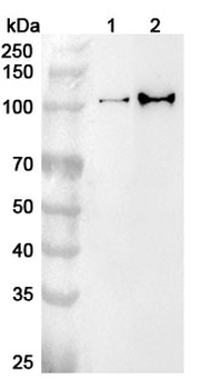 USP4 Rabbit Polyclonal Antibody