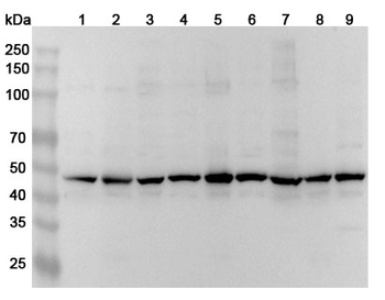 TUBG1 Rabbit Polyclonal Antibody