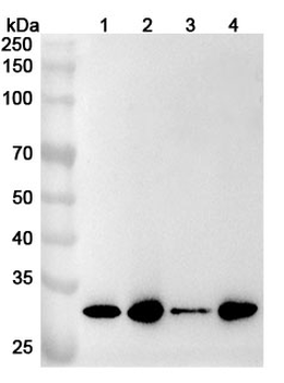 GTF2F2 Rabbit Polyclonal Antibody