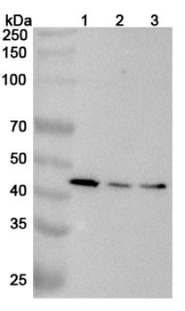GALT Rabbit Polyclonal Antibody