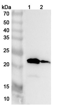 TNNC2 Rabbit Polyclonal Antibody