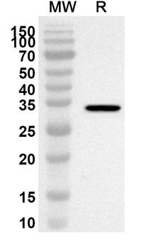NFATC1 Rabbit Polyclonal Antibody