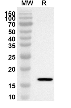 SCN2B Rabbit Polyclonal Antibody